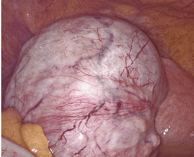 Property 1=Frame 1984078305