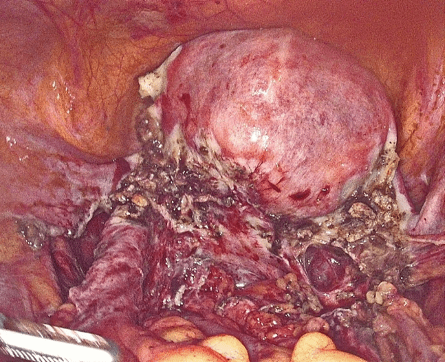 Property 1=Frame 1984078306