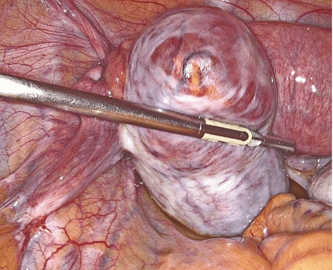 Property 1=Frame 1984078307