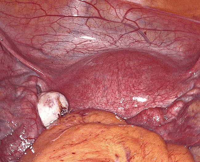 Property 1=Frame 1984078308